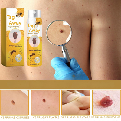 TagAway Piel Suave, Confianza de Vuelta
