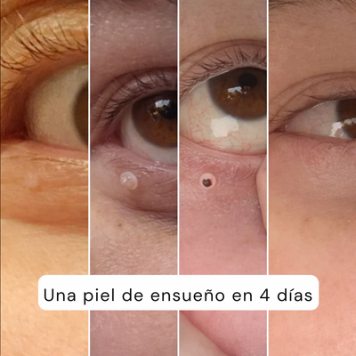 ALCURA™ – Piel Lisa en Solo 4 Días