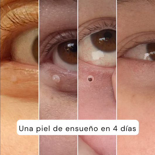 ALCURA™ – Piel Lisa en Solo 4 Días